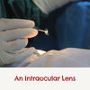 Donate an intraocular lens